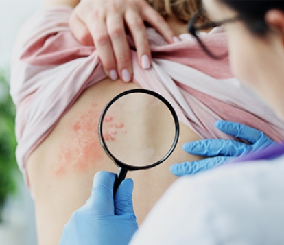 doctor examining rash on patients back