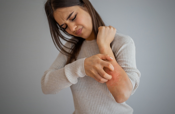 woman scratching her arm